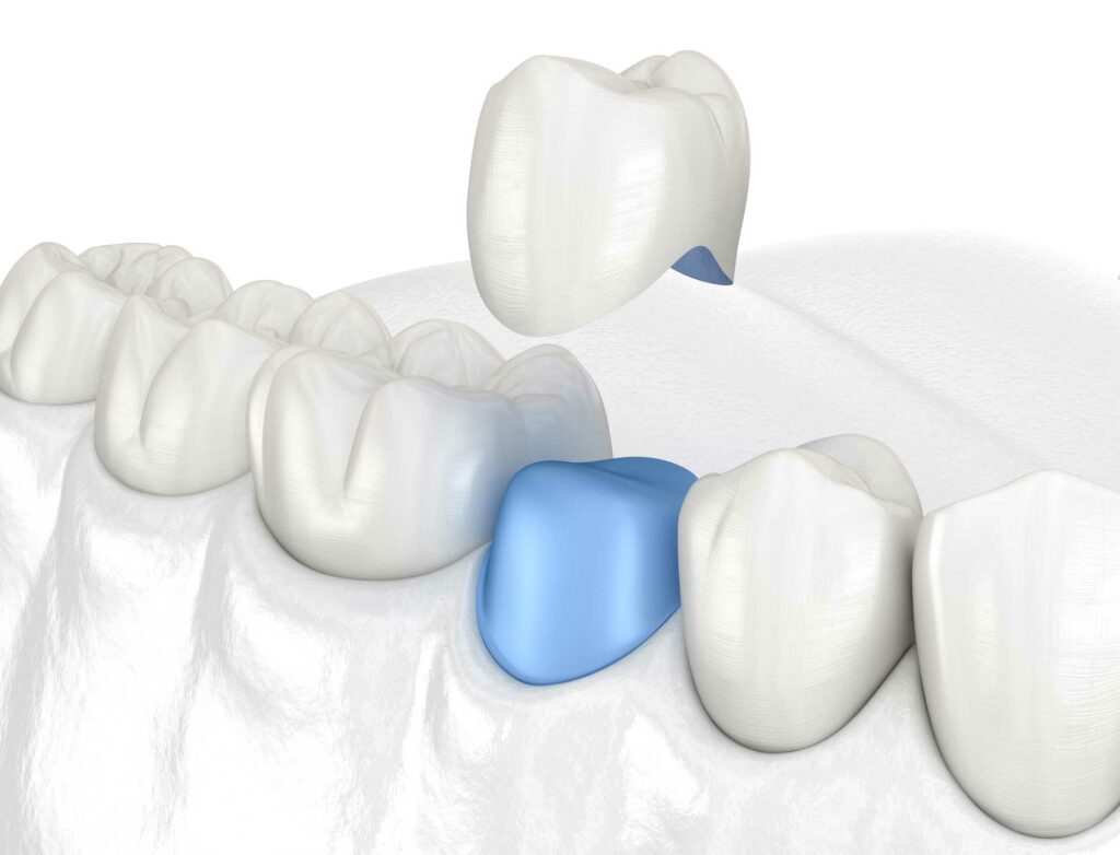 clínica dental en Bravo Murillo I dentistas en Bravo Murillo