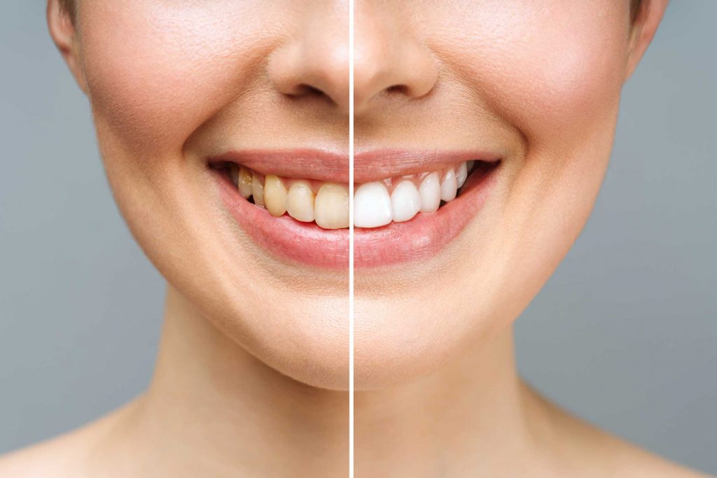 clínica dental en Bravo Murillo I dentistas en Bravo Murillo