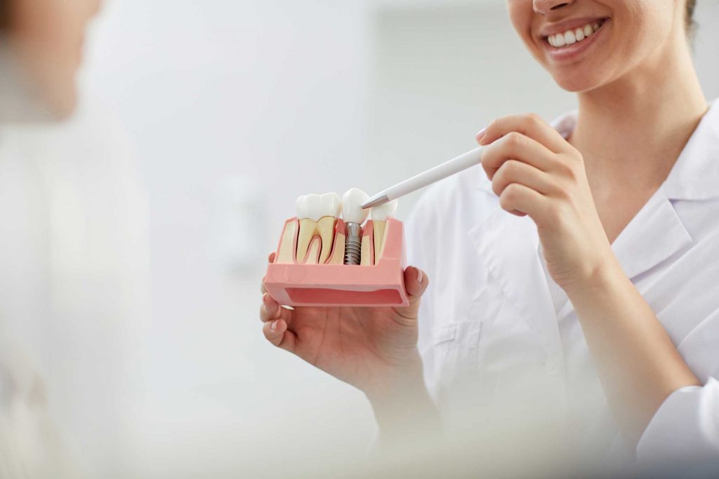 clínica dental en Bravo Murillo I dentistas en Bravo Murillo