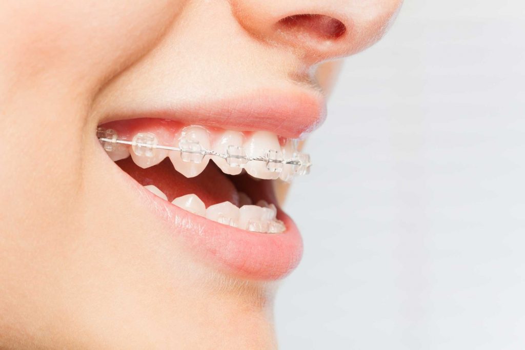 clínica dental en Bravo Murillo I dentistas en Bravo Murillo