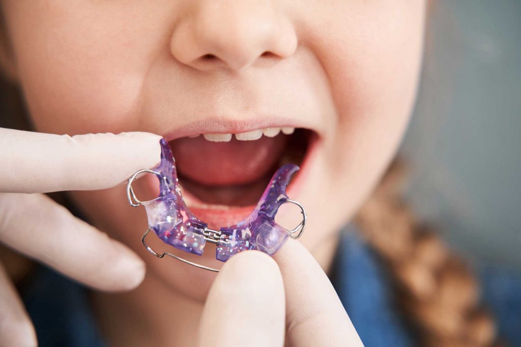 clínica dental en Bravo Murillo I dentistas en Bravo Murillo