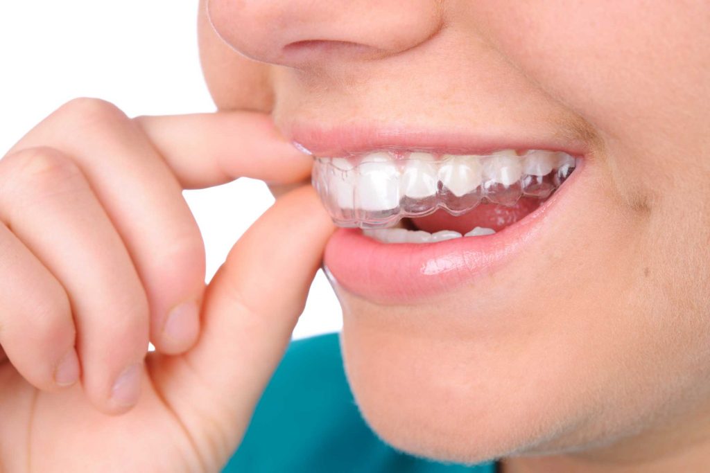 clínica dental en Bravo Murillo I dentistas en Bravo Murillo