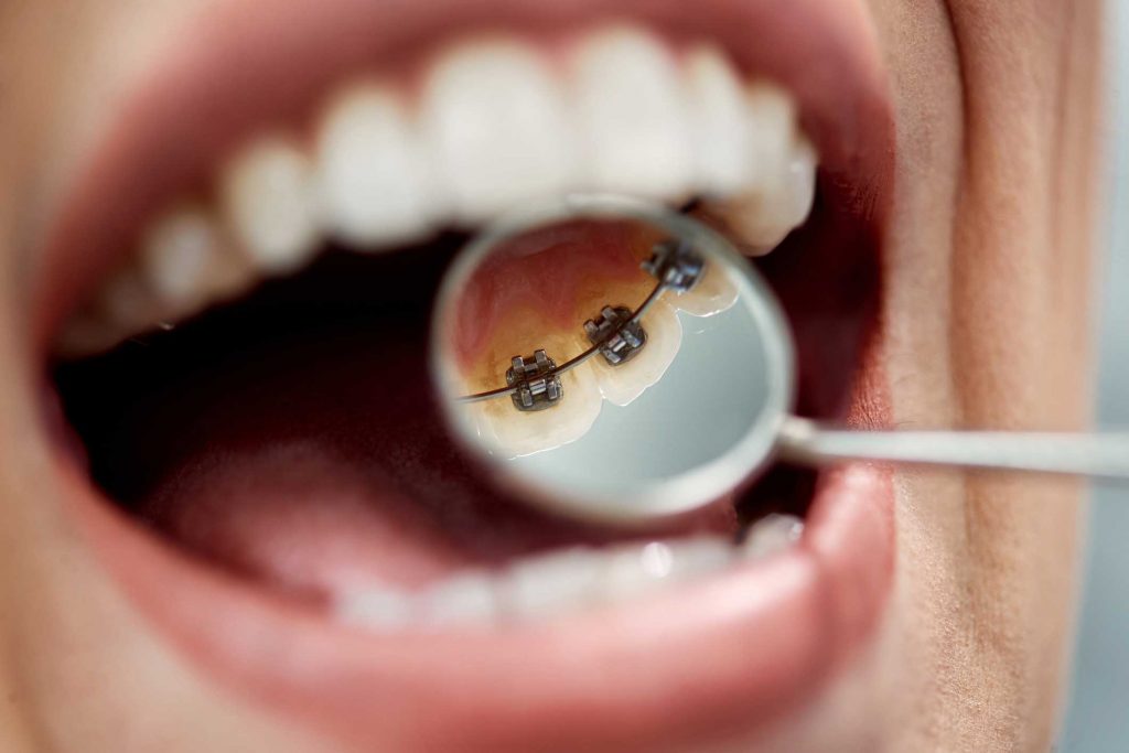 clínica dental en Bravo Murillo I dentistas en Bravo Murillo