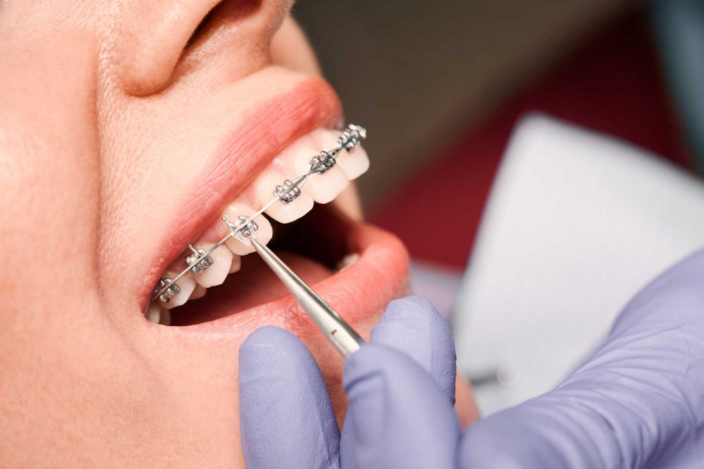 clínica dental en Bravo Murillo I dentistas en Bravo Murillo