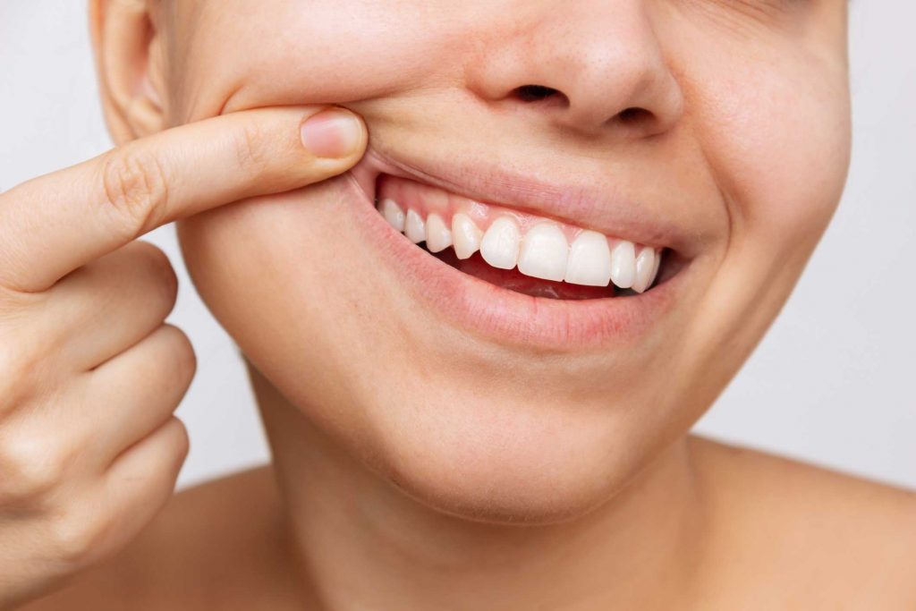 clínica dental en Bravo Murillo I dentistas en Bravo Murillo