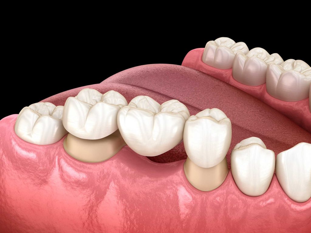 clínica dental en Bravo Murillo I dentistas en Bravo Murillo