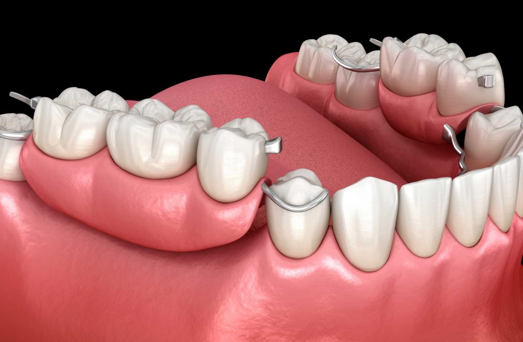 clínica dental en Bravo Murillo I dentistas en Bravo Murillo