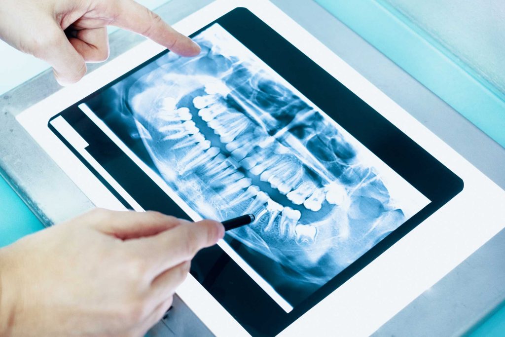 clínica dental en Bravo Murillo I dentistas en Bravo Murillo