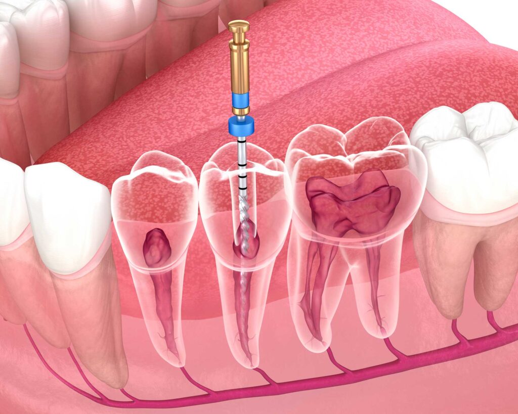 clínica dental en Bravo Murillo I dentistas en Bravo Murillo
