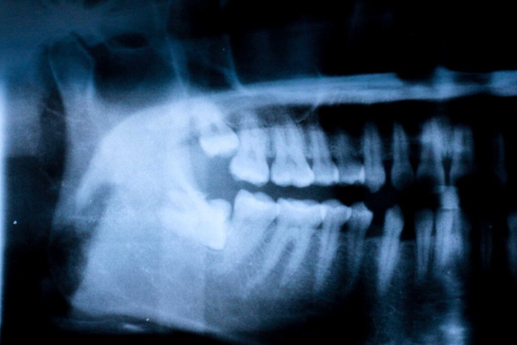 clínica dental en Bravo Murillo I dentistas en Bravo Murillo