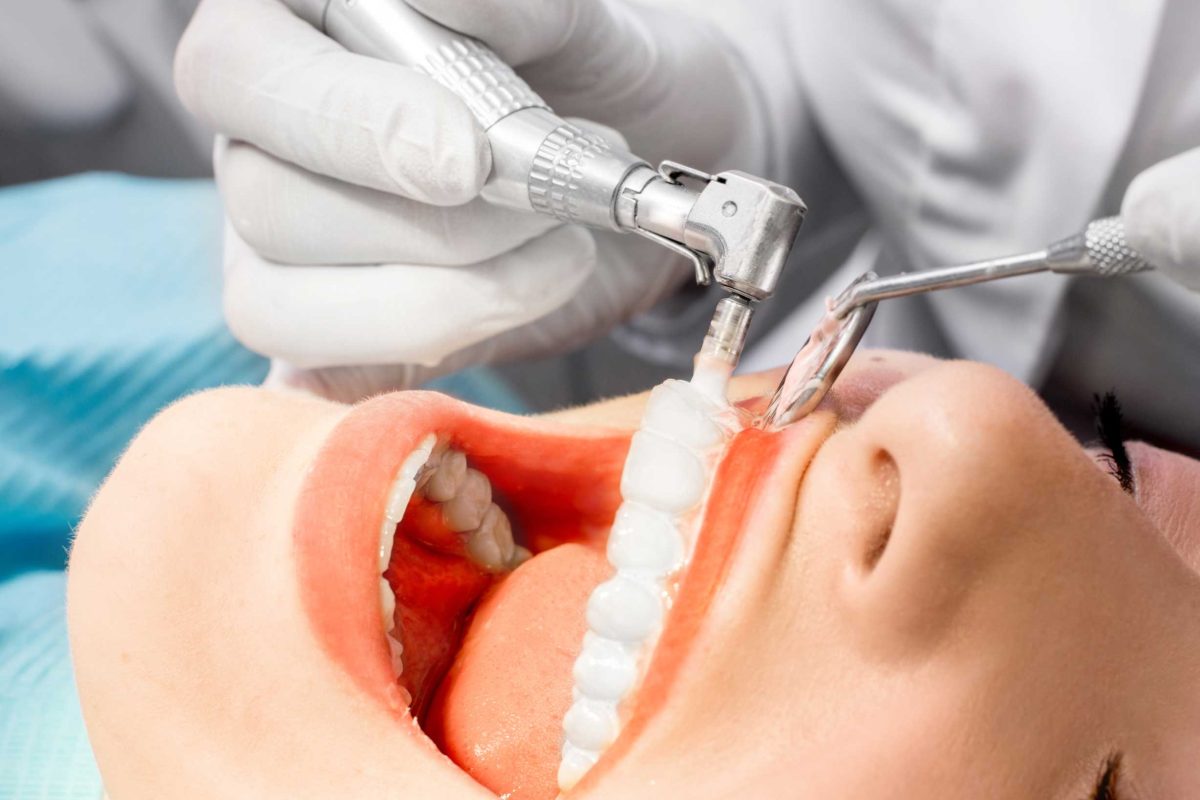 clínica dental en Bravo Murillo I dentistas en Bravo Murillo